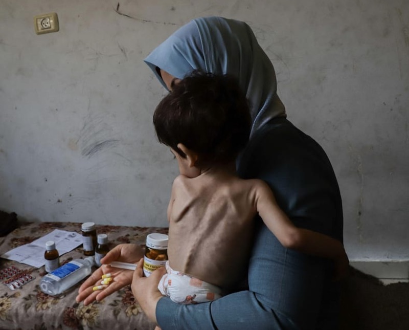 Fotos de 'fome e desespero' em Gaza são manipuladas, revela imprensa alemã  - Diário do Poder